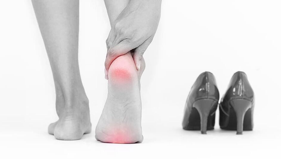 Wearing tight shoes is the cause of fungal disease