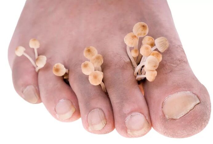 Foot fungus
