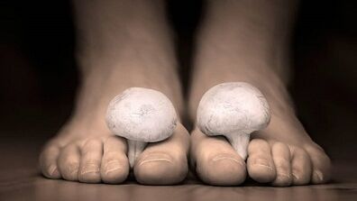 How to identify the presence of fungi on the legs