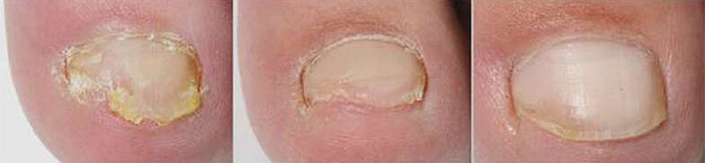 Treatment results
