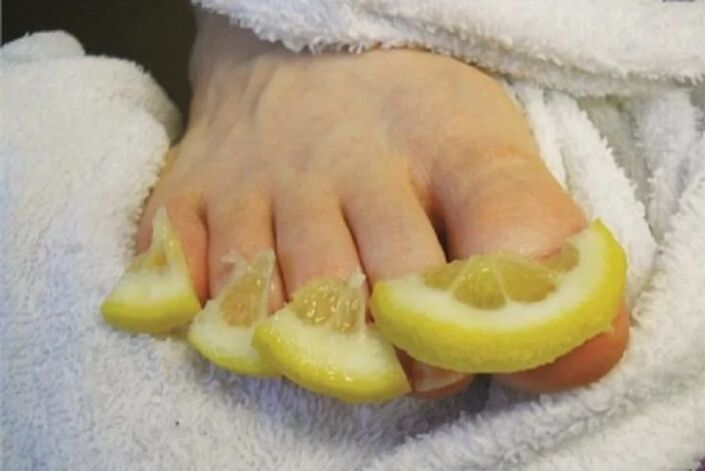 Lemon juice compress – a folk remedy for toenail fungus